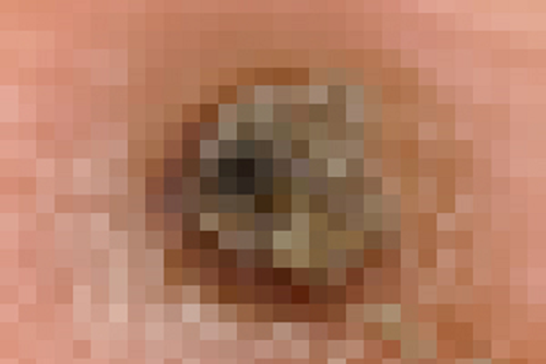 tunga-eggs.png