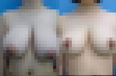 【悲報】Mカップ爆乳女子大生、せっかくの巨乳を自らナーフしてしまうｗｗｗｗ（画像あり）