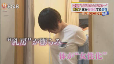 【画像】女性化乳腺症で悩む男の娘、ドスケベすぎるｗｗｗｗｗｗｗ
