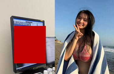 【画像】爆乳グラドルさん、レントゲン写真をアップするも “アレ” が透けて丸見えｗｗｗｗ